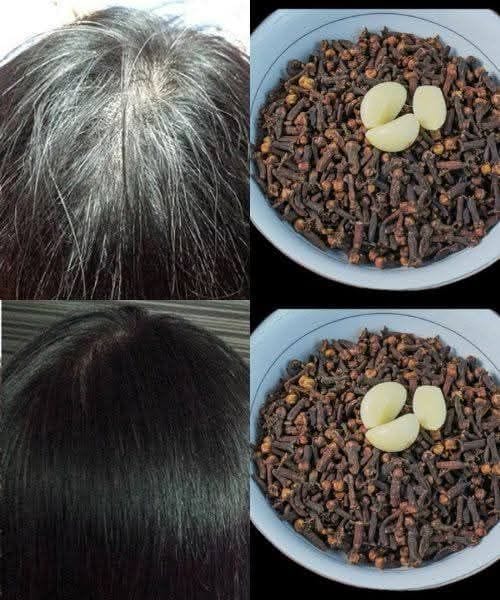 "Recupera tu color natural con ajo y clavo de olor: Una solución casera para las canas"