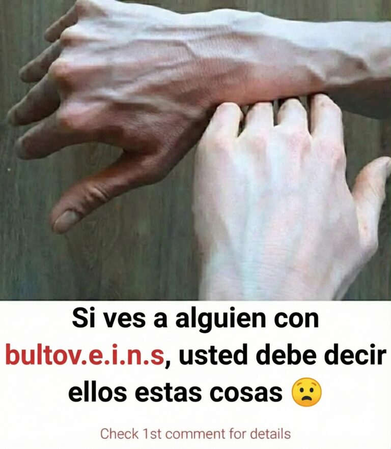 ¿Por qué tus venas de repente se abultan y se hacen visibles?